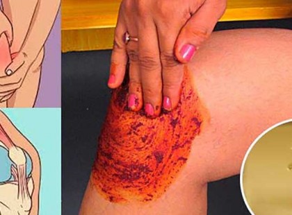 Az emberek megőrülnek ezért a receptért! Gyógyítja a térd-, a csont- és az ízületi fájdalmat!