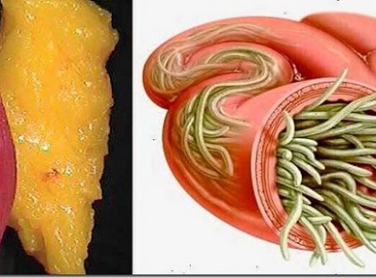 Használd ezt a két hozzávalót, hogy minden erőfeszítés nélkül kiürítsd tested zsír- és parazita raktárai!