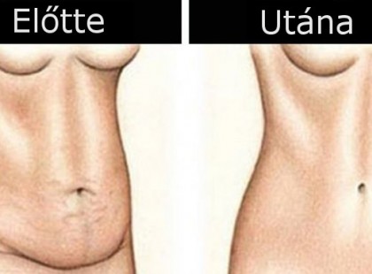 Mínusz öt kiló hét nap alatt! Az ideális étrend amely hozzásegít a karcsúbb alak eléréséhez!