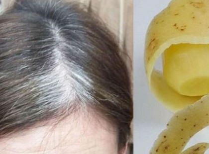 Mit tehetünk az ősz hajszálak ellen?