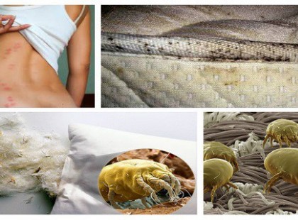 1,5 millió poratka élhet az ágyadban. Pusztítsd el őket ezzel az egyetlen dologgal