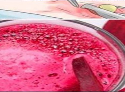 Amikor a nőgyógyász cisztát vagy miómát észlel, én csak megiszom ezt és a gondom eltűnik 4 nap alatt!