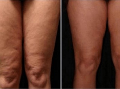 Amit a lábára kent, az neked is van otthon, csak nem jutott eszedbe