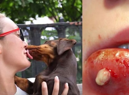 Az állatorvos tanácsa: Ezért NE ENGEDD hogy kutyád az arcodat nyalogassa