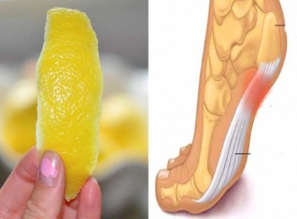 Citromhéjat dörzsölt a talpába… amikor megtudtuk, hogy miért, leesett az állunk!