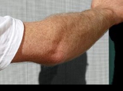 Figyelem! Valószínűleg hamarosan bekopognak önnél is! December 15-ig számítson rájuk!