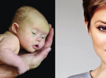 Egy Down kóros babát nevelő anyuka nyílt levelet írt Szinetár Dórának. 1 óra alatt 100 ezer megosztást kapott a levél!