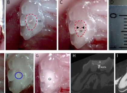 Ez a szupergyógyszer képes 6 hét alatt regenerálni a fogakat!