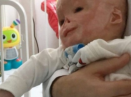 Az ápoló a kiságyra fektette a babát. Amikor néhány perccel később megnézte az arcát, sikított a rémülettől.