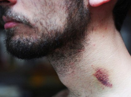 Ez a férfi meghalt, mert barátnője elkövette azt a hibát, amit a fiatalok 90 százaléka elkövet!