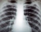 2018. Január 1-től óriási változás jön a leleteknél, zárójelentéseknél, ambuláns lapoknál, műtéti, kezelési dokumentumoknál! Ezt kell elintéznie! Mutatjuk lépésről lépésre!