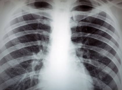 2018. Január 1-től óriási változás jön a leleteknél, zárójelentéseknél, ambuláns lapoknál, műtéti, kezelési dokumentumoknál! Ezt kell elintéznie! Mutatjuk lépésről lépésre!