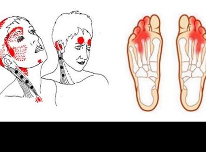 A súlyos B12 vitaminhiány jelei! ne vedd könnyedén a tüneteket!