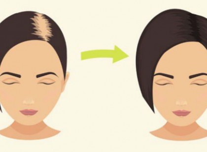 Készítsd házi szódabikarbóna sampont: vége a hajhullásnak, újjáéled és nagyon erős lesz tőle a haj