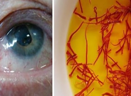 Nem akarsz többé szemüveget viselni? Ennek az egy dolognak köszönhetően talán nem is kell!