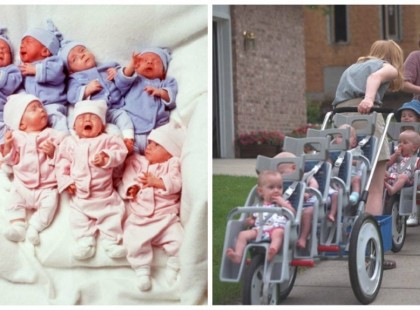 Ők voltak a világ első hetes ikrei – most 20 évvel később így néznek ki