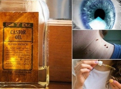 A ricinusolaj 11 elképesztő felhasználási módja