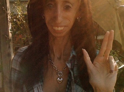 Gyerekkorában kicsúfolták az arca miatt… de 25 évvel később kritizálói szóhoz sem jutnak