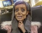 Angelina Jolie-ra akart hasonlítani a fiatal lány,így 50 plasztikai műtéten esett át!Szerinted?