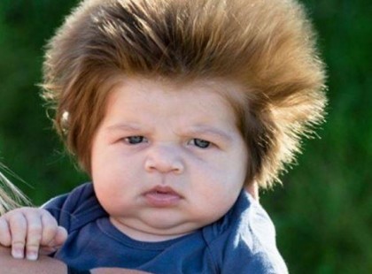 Ő az a baba aki hajviseletével mindenkit megdöbbentett: így néz ki egy év múlva