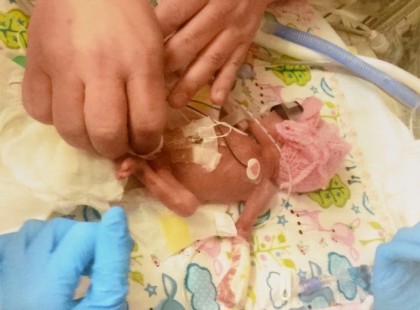 A baba két nappal az abortusz limit után született: 9 hónappal később él és virul