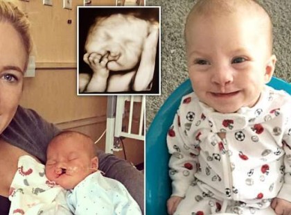 Az anyának abortuszt javasolnak és 3 hónap múlva fájdalmas felfedezést tesz