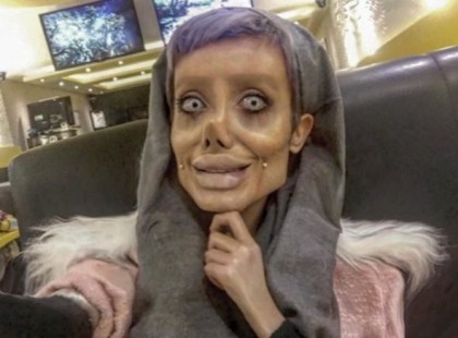 Angelina Jolie-ra akart hasonlítani a fiatal lány,így 50 plasztikai műtéten esett át!Szerinted?