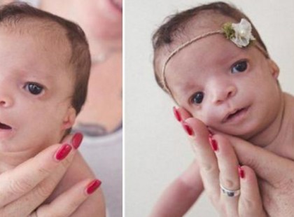 Az örökbefogadó anya sírva elrohan mikor meglátja a kislányt, az anya drasztikus döntést hoz