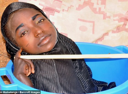 Ez a lány évek óta műanyag tálban éli az életét… senki sem tudja, hogy pontosan milyen betegségben szenved!