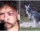 A kenguru gyorsabb a vadásznál és eltöri a fiú állkapcsát mielőtt lőne