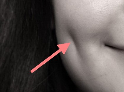 Neked is vannak gödröcskék az arcodon? Nem is gondoltad volna, hogy miről árulkodik!