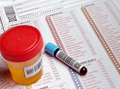 Most érkezett! Hiába van érvényes TB-D ezentúl fizetned kell a VÉRVÉTELÉRT, LABORÉRT, VIZELETVIZSGÁLATÉRT ha ezért kapsz beutalót a laborba! MINDENKINEK FIZETŐS! >>>