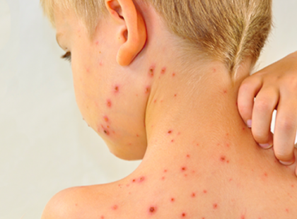 Figyelem! Most érkezett!!! ITT VAN A KANYARÓ BUDAPESTEN!!!! 14 hónapos kislányt ápolnak az egyik fővárosi kórházban! MINDEN SZÜLŐT FIGYELMEZTETNEK – A KÖVETKEZŐT KELL TENNI!