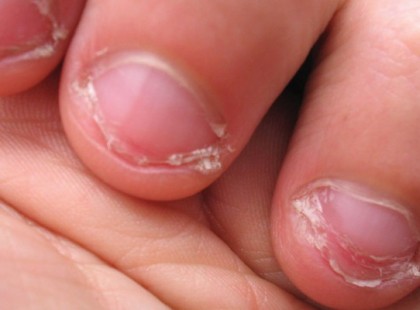 RÁGOD A KÖRMÖDET? A PSZICHOLÓGUSOK DÖBBENETES DOLGOT MONDANAK A LELKI HÁTTERÉRŐL