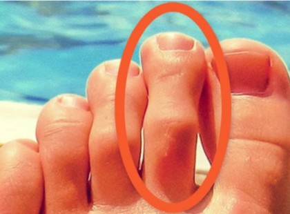 A tested jelez: 8 tünet, ami megmutatja, hogy a tested segítségért kiált!