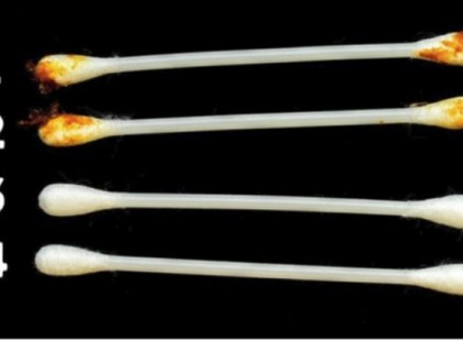 Fülünk jelzi az egészségi állapotunkat, ezt a 8 jelet soha ne hagyd figyelmen kívül