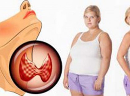 Így próbálj lefogyni a pajzsmirigy alulműködés diéta segítségével