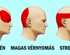 Így szabadulhatsz meg a fejfájástól 5 perc alatt pirulák nélkül