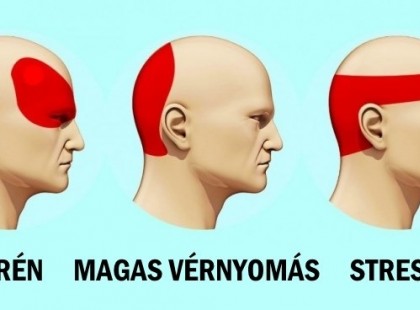 Így szabadulhatsz meg a fejfájástól 5 perc alatt pirulák nélkül