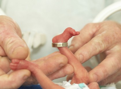 A terhesség 24. hetében született meg ez a pici lány. Még az orvosok sem hittek benne, de csodálatos élni akarásával rácáfolt mindenkire