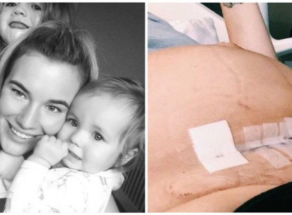 Az anya mindenkinek szeretné elmondani a császárral szült nőkről ezt az igazságot