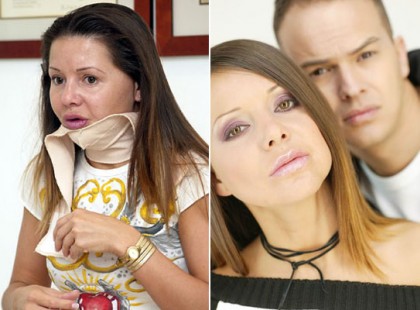 JUDY-NAK36 MŰTÉTEN KELLETT ÁTESNIE A BALESETE UTÁN. ENNYIRE GYÖNYÖRŰ VOLT ELŐTTE