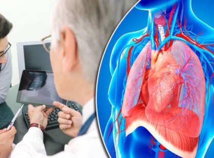 Ez az egyik legárulkodóbb jele a tüdőráknak! Ezt neked is ismerned kell! A legtöbbször figyelmen kívül hagyják ezt a tünetet, mert eszükbe sem jutnak, hogy az egyik legveszélyesebb betegségre utalhat