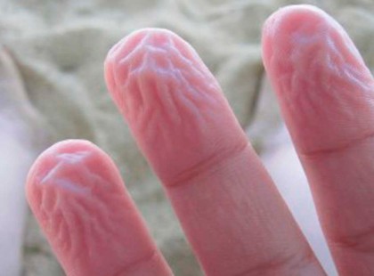 Az emberi test 9 védekező rendszere! Én nem tudtam, hogy a csuklás is ezek közé tartozik…