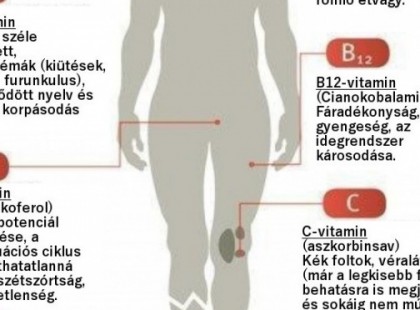 Ezt mindenképpen mentsd el! Itt a teljes lista – melyik tünet, milyen vitamin hiányára utal!!! Az alábbiakban egy egyszerű tesztet láthatsz, amivel könnyedén meghatározhatod, hogy szervezetednek melyik vitaminból van hiánya >>>