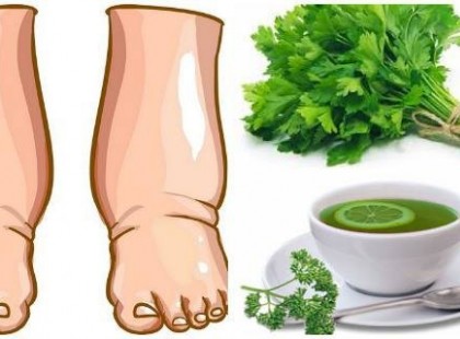 A hőséggel jön a lábdagadás!!! Ez a hatékony, házilag elkészíthető tea néhány nap alatt meggyógyítja a lábdagadást!