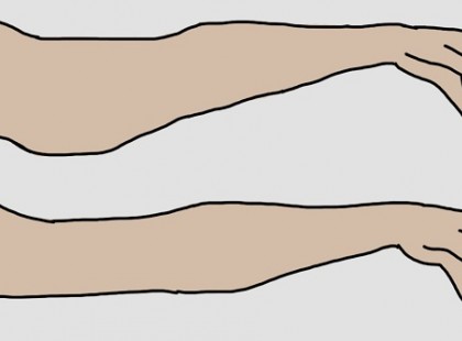 Most figyelj! NAPI 3 perc és vége a löttyedt karoknak! 1 hét múlva már látható eredmény!!! Íme a gyakorlat :