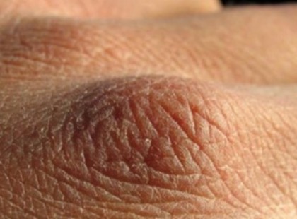 10 jele annak hogy több vizet kellene innod