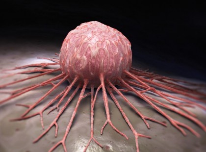 Mutatjuk az a 8 élelmiszert ami segíti a daganatos sejtek terjedését, növekedését.Ha megtudod melyek azok,megfogsz lepődni!