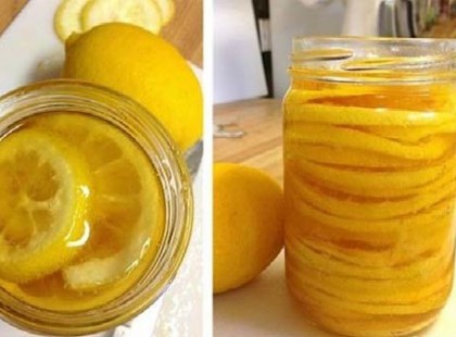 Régi német orvosság, amely megtisztítja az artériákat, segít csökkenti a koleszterinszintet és javítja az immunrendszert!